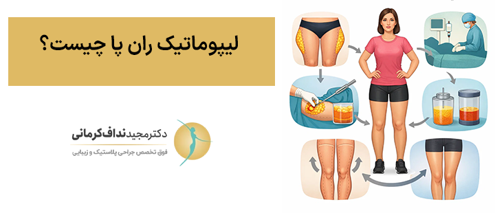 لیپوماتیک ران پا چیست؟