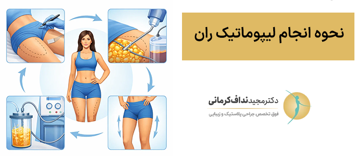 نحوه انجام لیپوماتیک ران