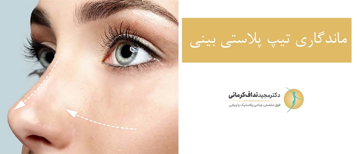 ماندگاری تیپ پلاستی بینی