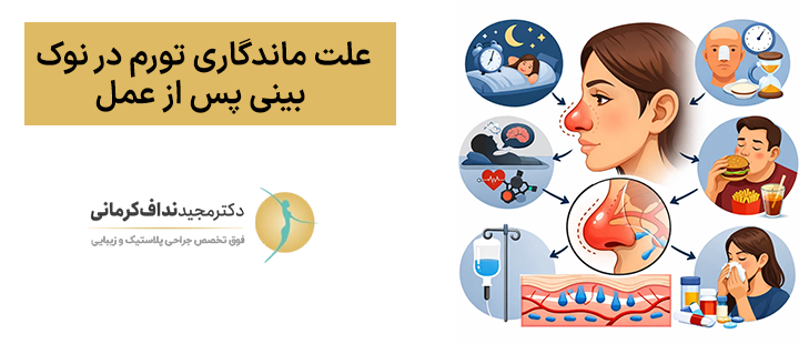 علت ماندگاری تورم در نوک بینی پس از عمل
