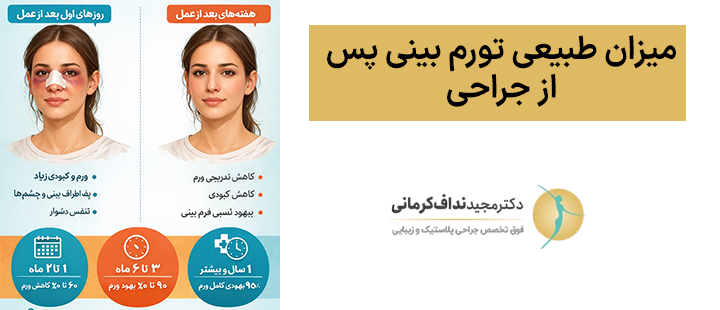 میزان طبیعی تورم بینی پس از جراحی