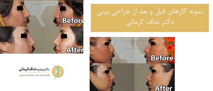 نمونه کارهای دکترنداف کرمانی نداف کرمانی