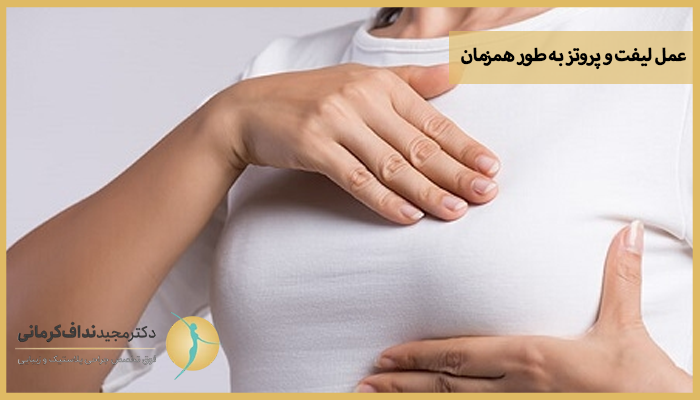لیفت و پروتز سینه به طور همزمان 