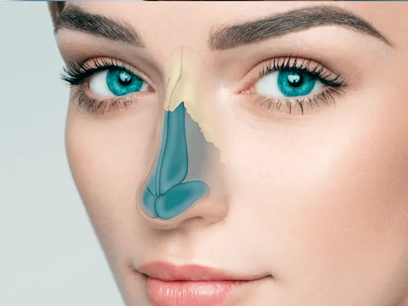 کارهای قبل از عمل بینی