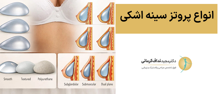 انواع پروتز سینه اشکی