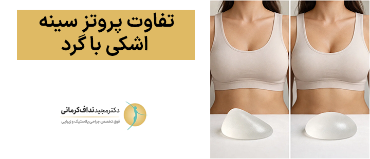 تفاوت پروتز سینه اشکی با گرد