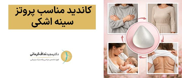 کاندید مناسب پروتز سینه اشکی