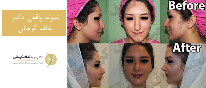 نمونه کار واقعی دکتر نداف کرمانی