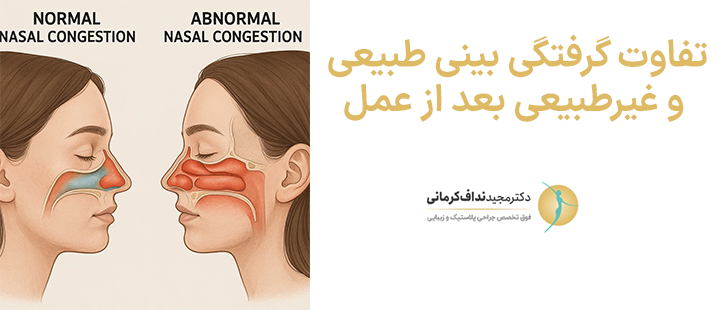 تفاوت گرفتگی بینی طبیعی و غیرطبیعی بعد از عمل
