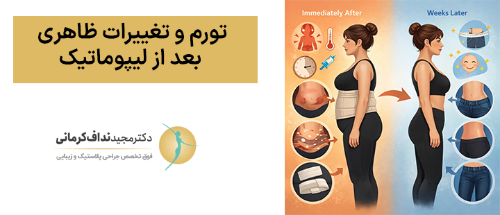 تورم و تغییرات ظاهری بعد از لیپوماتیک