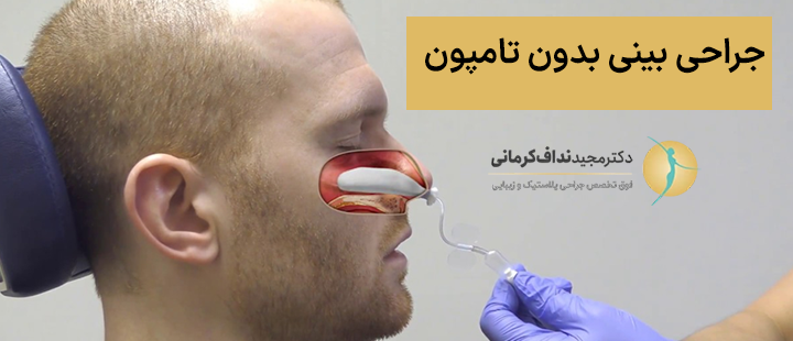 جراحی بینی بدون تامپون