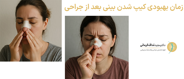 زمان بهبودی کیپ شدن بینی بعد از جراحی