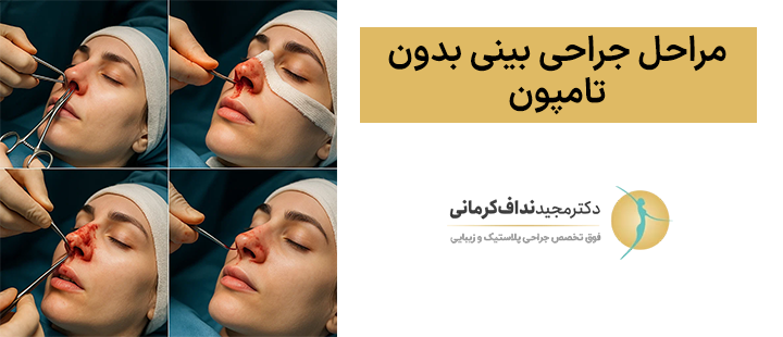 مراحل جراحی بینی بدون تامپون