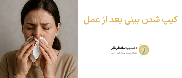 کیپ شدن بینی بعد از عمل